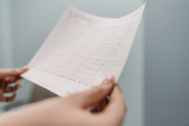 Ostry zawal serca ekg sor