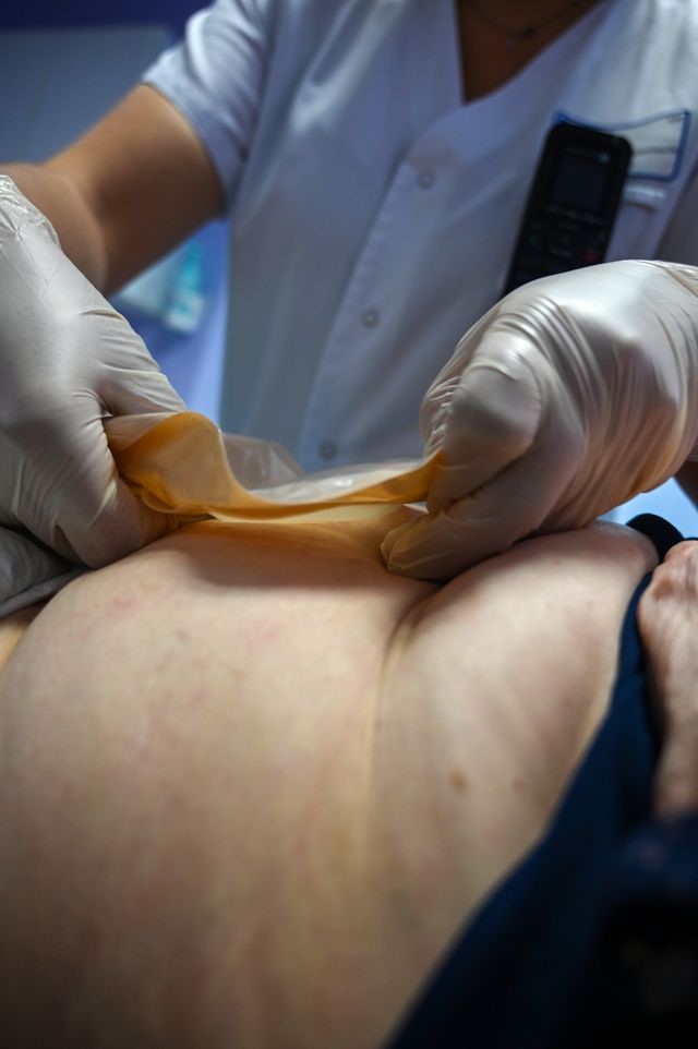 Pielęgniarka stomijna z pacjentem